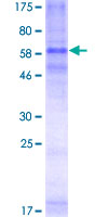 12.5% SDS-PAGE Stained with Coomassie Blue.